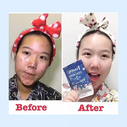 DEAL Frozen Collagen + 2 in 1 Whitening,60 Capsules, Made in Thailand